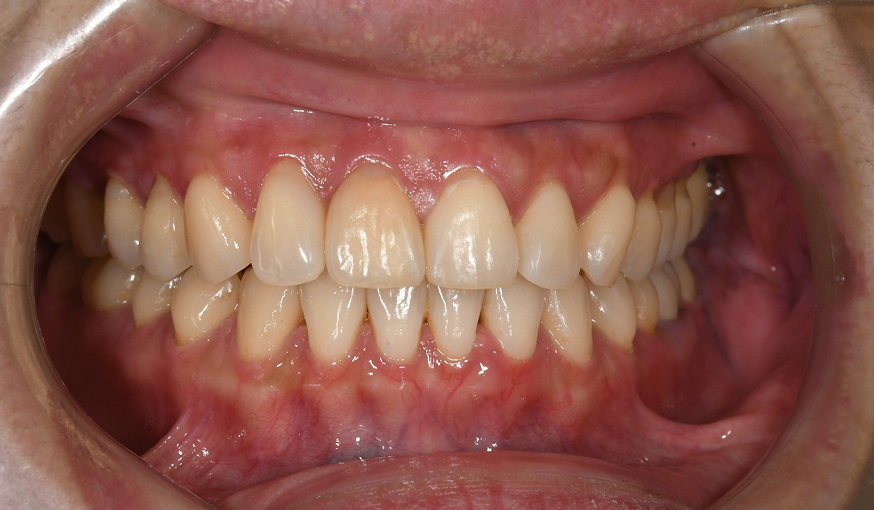 after image