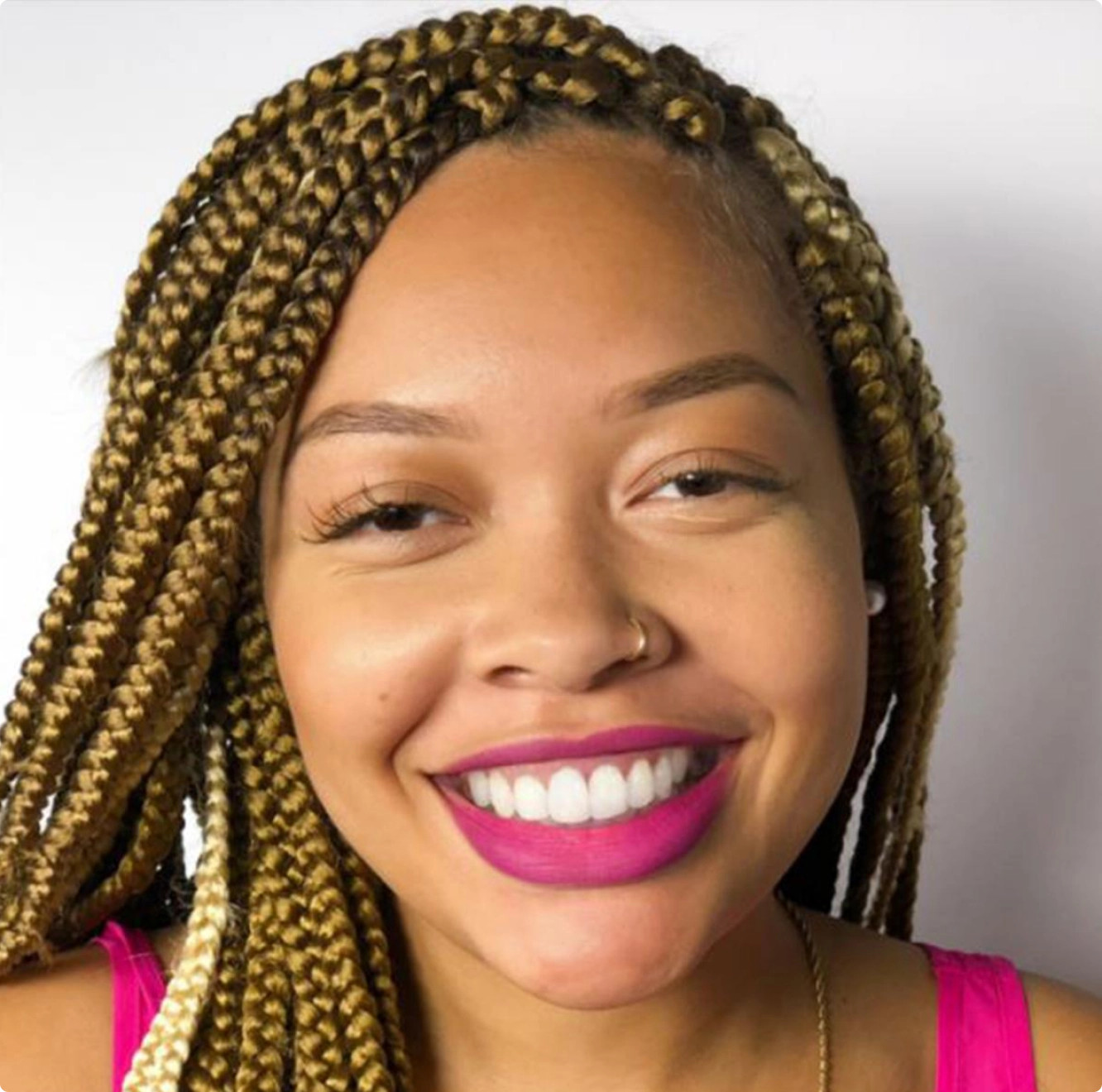 Black woman's smile after her Invisalign® treatment