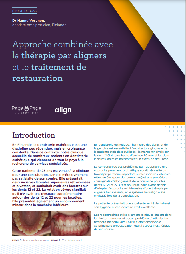 Combined approach of aligner therapy and prosthetic treatment