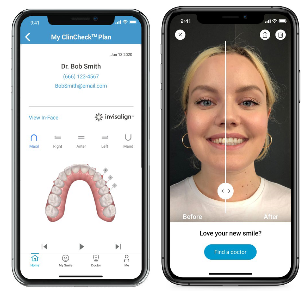 Meet-the-My-Invisalign-App tet
