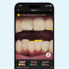 image-card-phone-teeth-seamless-and-intelligent