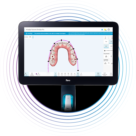 image-accordion-arch-control