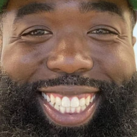 رجل يبتسم بعد نجاح علاج Invisalign®
