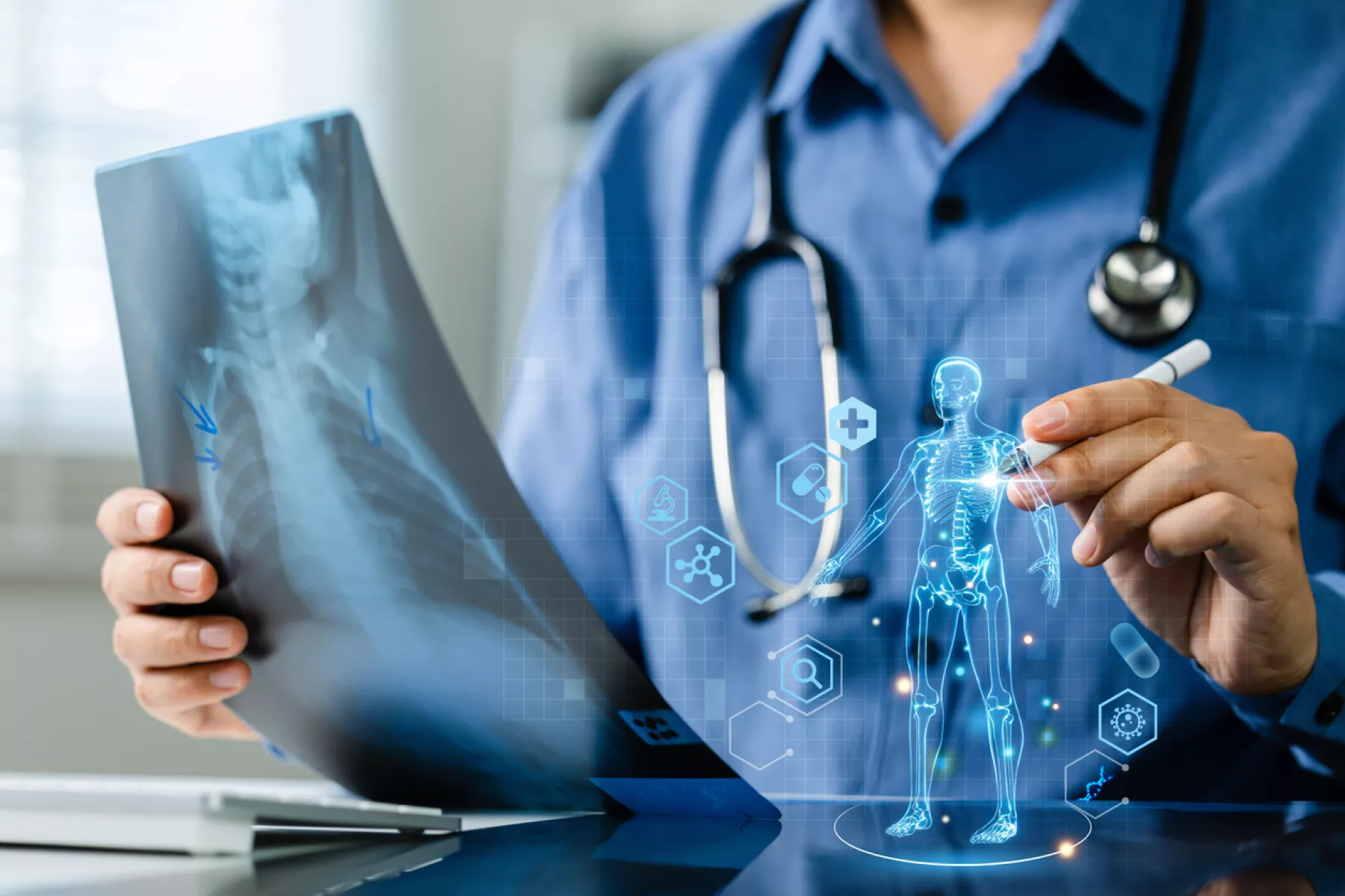 México enfrenta un déficit de 90% de fisioterapeutas; la IA busca cerrar la brecha.