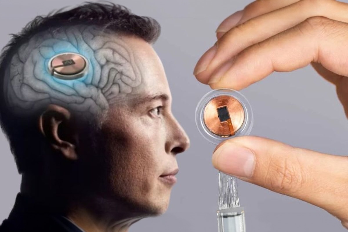 China va por el liderazgo de Musk en implantes cerebrales.