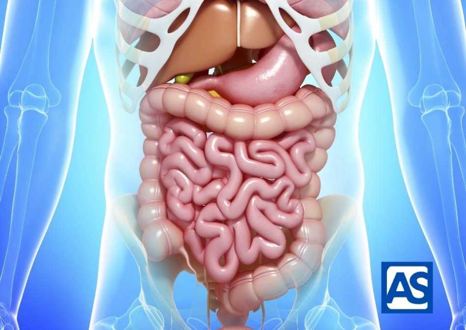 ¿Cuáles son las causas de la perforación gastrointestinal?