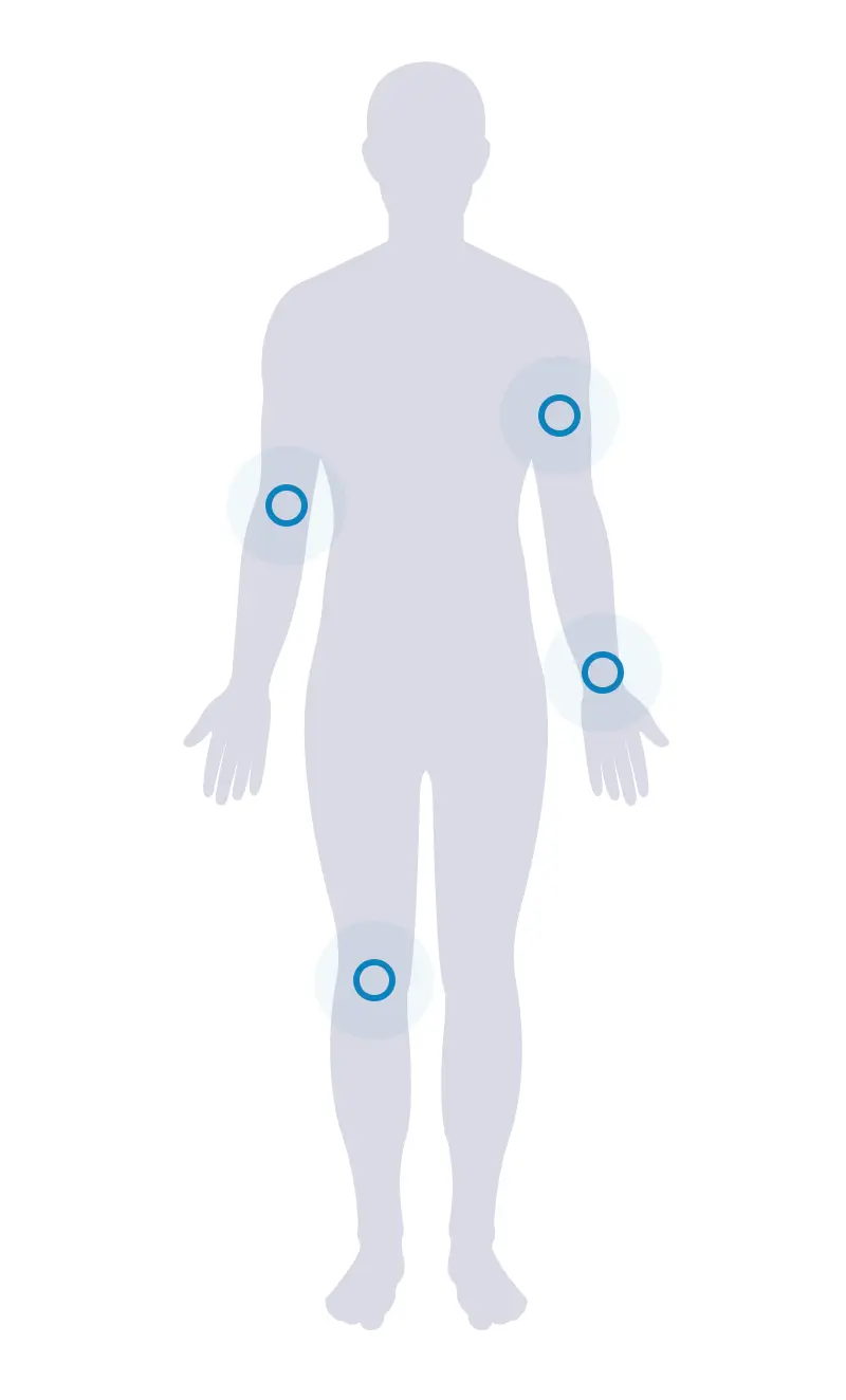 somaderm-usage