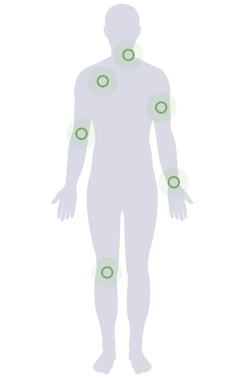 SomaDerm+AWE Usage Body Illustration