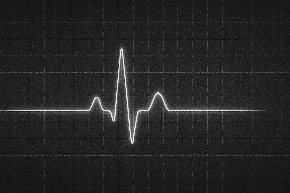 ECG
