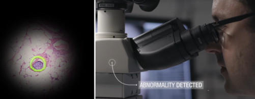 The AR microscope is capable of drawing an outline over the digital image of biological sample during observation The AR microscope is capable of drawing an outline over the digital image of biological sample during observation