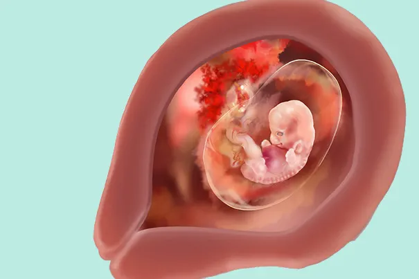 Embryo Lage in der 7 SSW