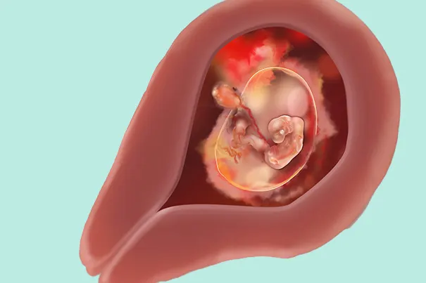 Embryo Lage in der 5. SSW