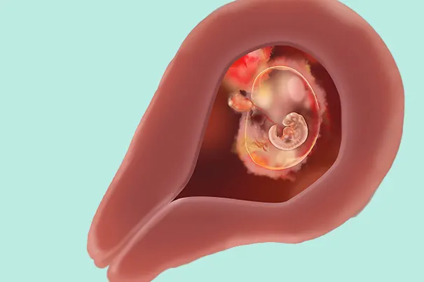 Embryo Lage in der 4 SSW