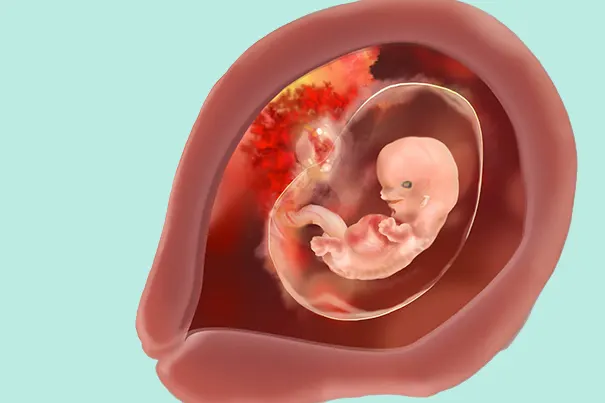 Embryo Lage in der 8 SSW