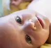 Baby mit Kopfgneis 