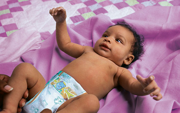 Ist säuglinge ansteckend wann für herpes ab Neugeborene: Herpes