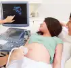 Geschlechtsbestimmung eines Babys