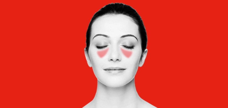 Maxillary sinus congestion and pressure highlighted behind cheekbones