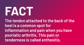 Fact - The tendon attached to the back of the heel is a common spot for inflammation and pain when you have psoriatic arthritis. This pain or tenderness is called enthesitis