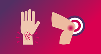 Your Skin And Joints Could Be Connected