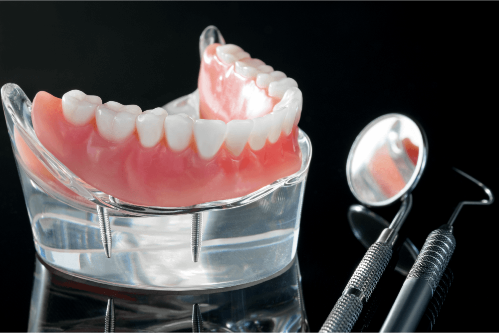 假牙怎麼挑？固定式假牙＆活動式假牙哪種比較好？醫師解析給你聽