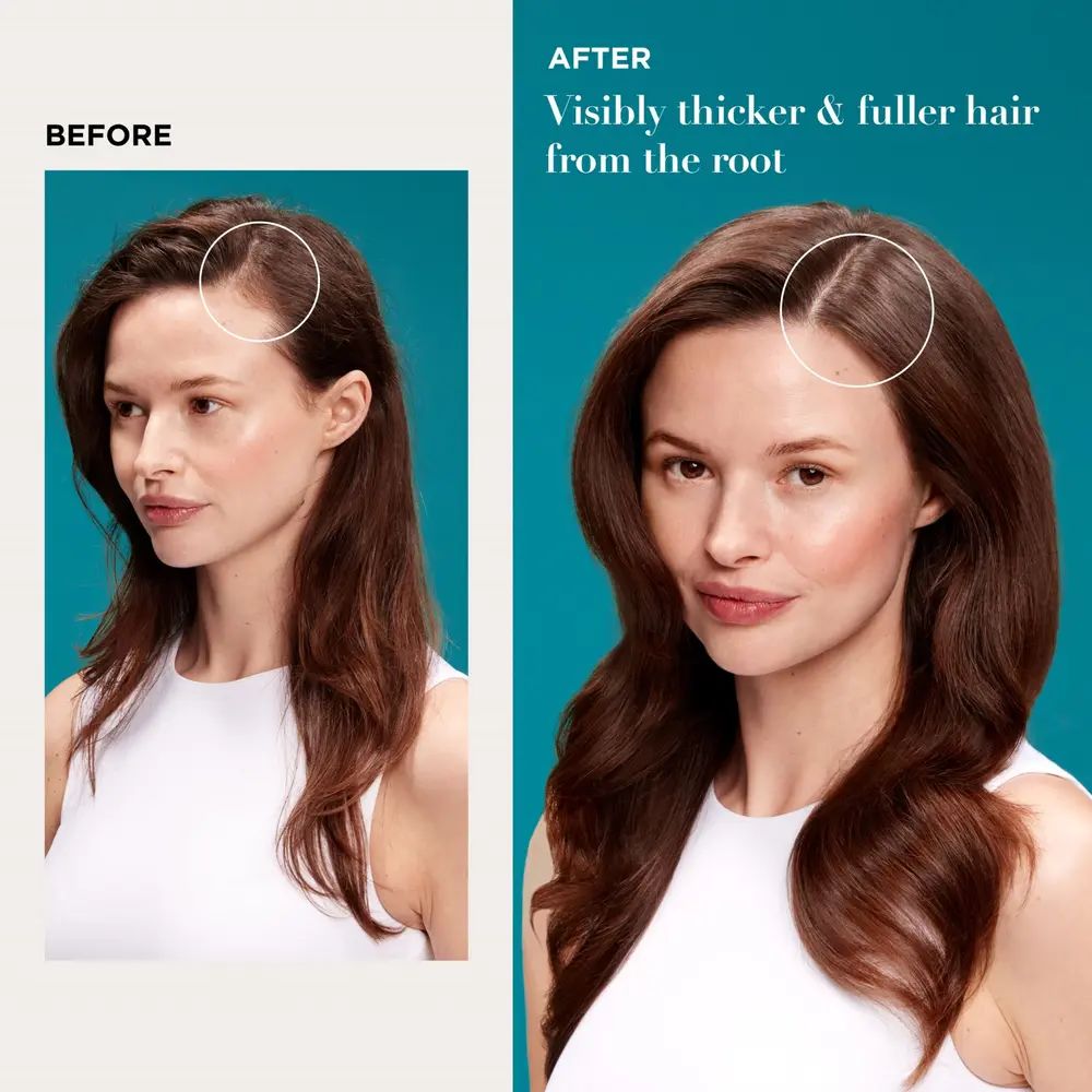 Before and After image displaying woman with visibly thicker & fuller hair from the root