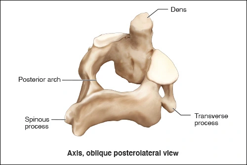 Illustration showing the oblique posterolateral view of the Axis