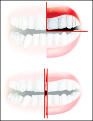 Adult Teeth - Figure 2