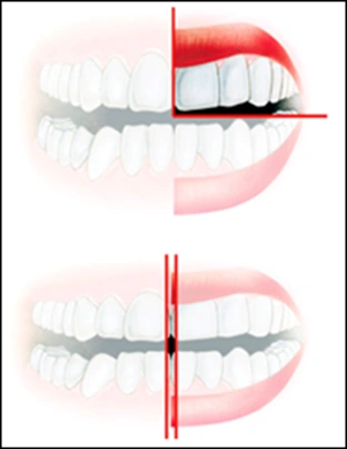 ce542 - Content - Adult Teeth - Figure 2