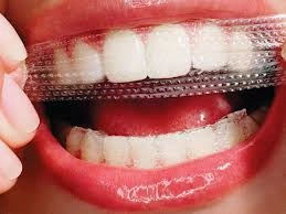 Patient Material - Teeth Whitening – Dental Care - Image 6
