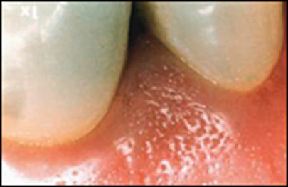 ce542 - Content - Supporting and Surrounding Structures of the Teeth - Figure 1