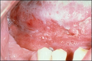 CE348 - Content - Clinical Appearance - Figure 2