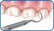 Patient Material - Why a Regular Dental Check Up is Important - Image 3