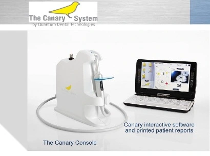 Photo showing the caries diagnostic system, The Canary System