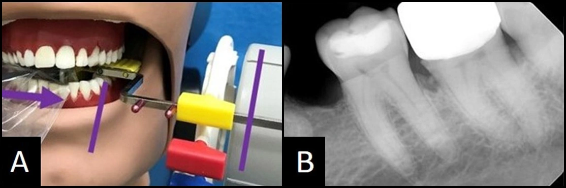 ce660 - Fig 11