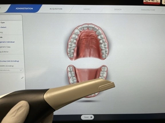 Preparing for digital scanning of the dental arches and bite registration in lieu of traditional impression taking with alginate and trays. 