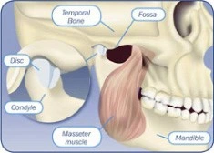 Patient Material - What is TMJ Disorder? - Image 1