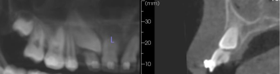 Orthodontics - Figure 1