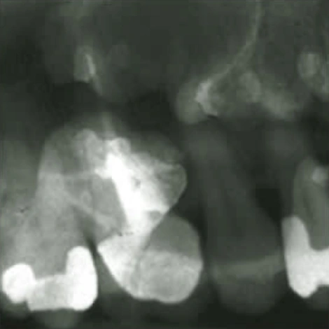 Intraoral Imaging: Basic Principles, Techniques and Error Correction (ce559) - Introduction