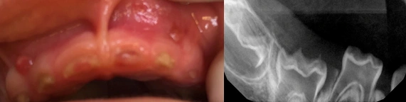 ce4 - Content - Dentinogenesis Imperfecta - Figure 1