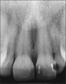 Alterations in the Size of Teeth - Figure 1