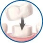 Patient Material - Restorative Dentistry - Image2