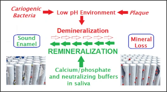 Process diagram for the Remineralization process