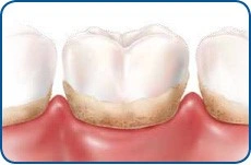 Patient Material - Why a Regular Dental Check Up is Important - Image 2