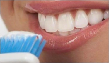 Tooth Whitening - Figure 7