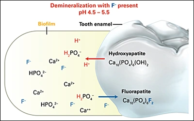 Diagram showing demineralization reactivity