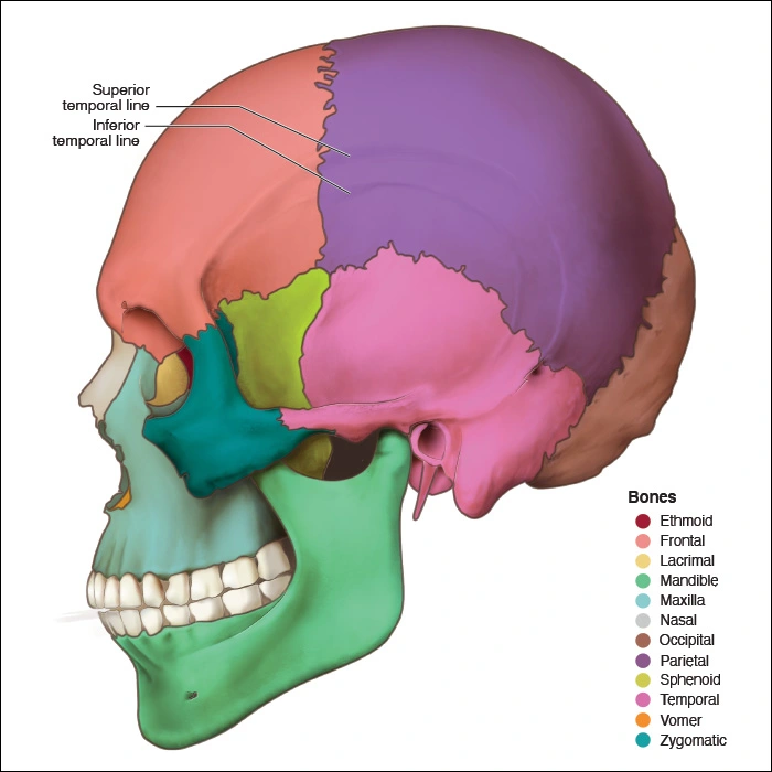 Illustration showing the temporal lines along the side of the skull