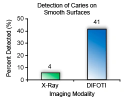 Chart showing the detection percentage of caries on smooth surfaces between xrays and DIFOTI