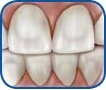 Patient Material - Teeth Whitening – Dental Care - Image 2