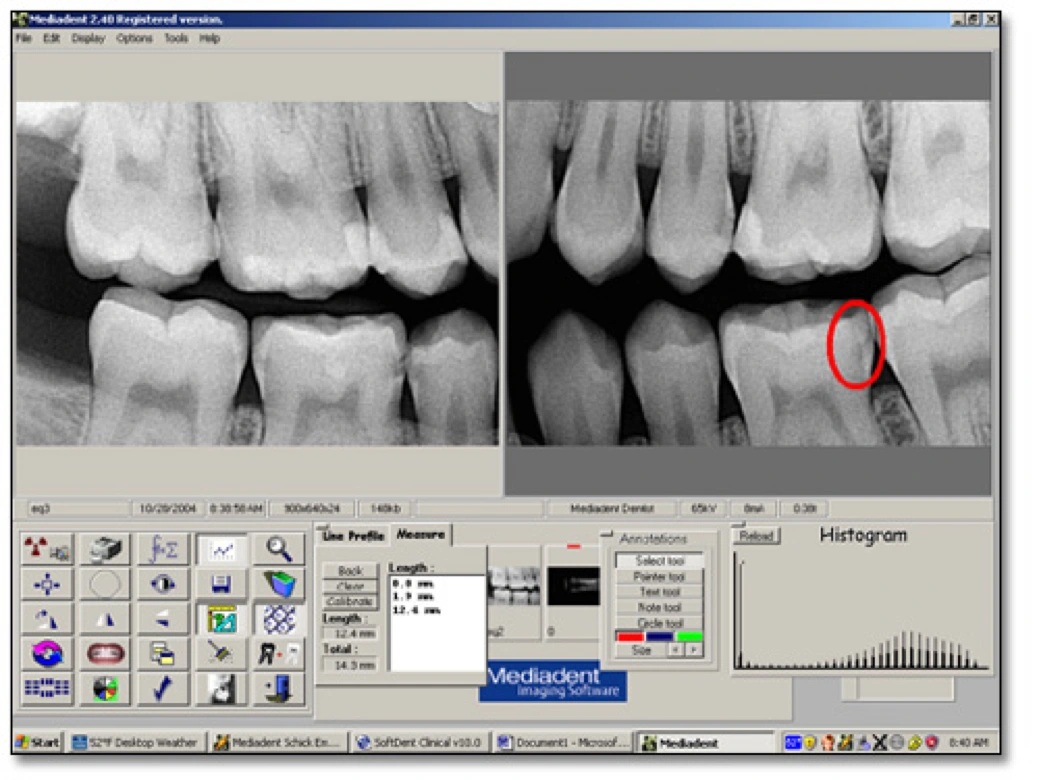 Example of computer software program to view digital radiographs